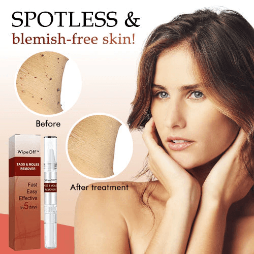 🎁BUY 1 GET 1 FREE🎁WipeOff™ Tags & Moles Remover - Emporium Shop