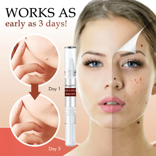 🎁BUY 1 GET 1 FREE🎁WipeOff™ Tags & Moles Remover - Emporium Shop
