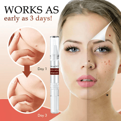🎁BUY 1 GET 1 FREE🎁WipeOff™ Tags & Moles Remover - Emporium Shop